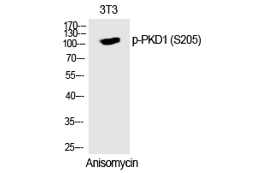 Western blot - PKD1 (Phospho-Ser205) Polyclonal Antibody from Signalway Antibody (12323) - Antibodies.com