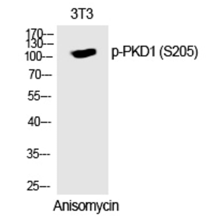 Western blot - PKD1 (Phospho-Ser205) Polyclonal Antibody from Signalway Antibody (12323) - Antibodies.com