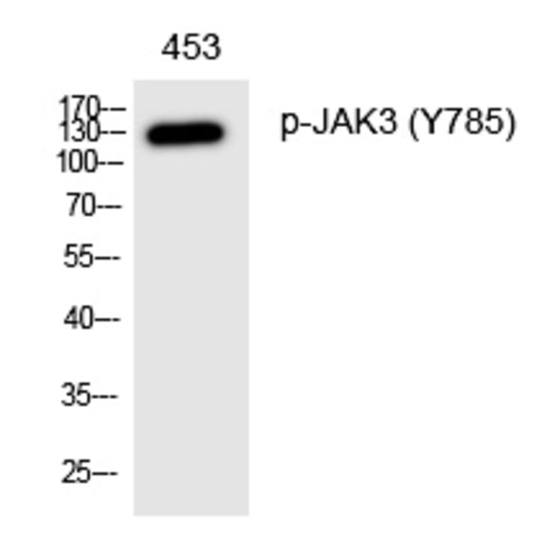 Western blot - JAK3 (Phospho-Tyr785) Polyclonal Antibody from Signalway Antibody (12331) - Antibodies.com