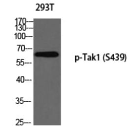 Western blot - Tak1 (Phospho-Ser439) Polyclonal Antibody from Signalway Antibody (12337) - Antibodies.com