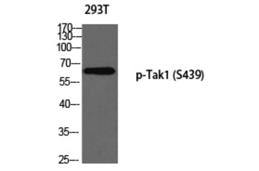 Western blot - Tak1 (Phospho-Ser439) Polyclonal Antibody from Signalway Antibody (12337) - Antibodies.com