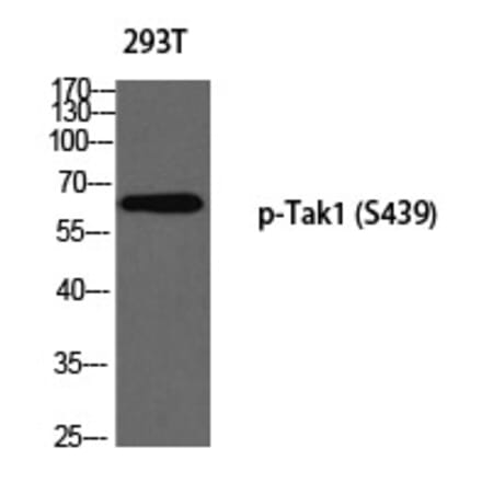 Western blot - Tak1 (Phospho-Ser439) Polyclonal Antibody from Signalway Antibody (12337) - Antibodies.com