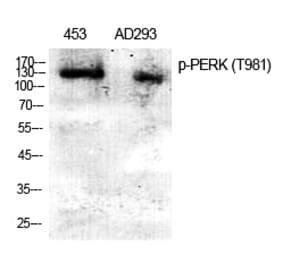 Western blot - PERK (Phospho-Thr981) Polyclonal Antibody from Signalway Antibody (12379) - Antibodies.com