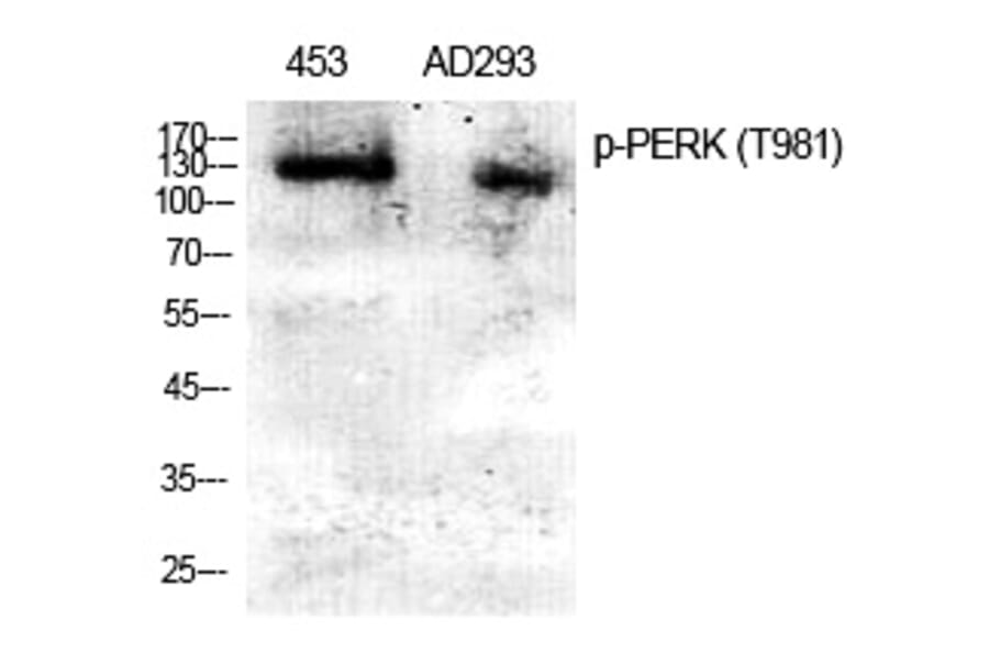 Western blot - PERK (Phospho-Thr981) Polyclonal Antibody from Signalway Antibody (12379) - Antibodies.com