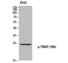 Western blot - TIRAP (Phospho-Tyr86) Polyclonal Antibody from Signalway Antibody (12384) - Antibodies.com