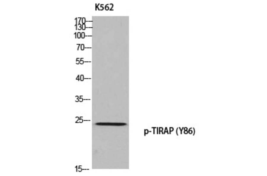 Western blot - TIRAP (Phospho-Tyr86) Polyclonal Antibody from Signalway Antibody (12384) - Antibodies.com
