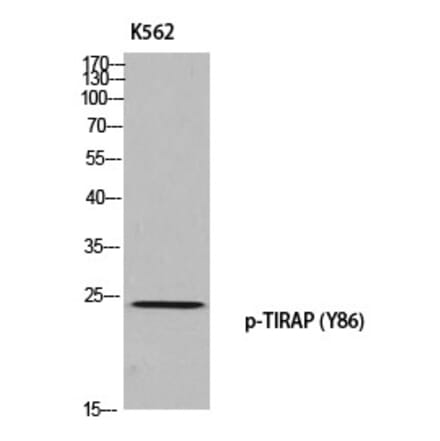 Western blot - TIRAP (Phospho-Tyr86) Polyclonal Antibody from Signalway Antibody (12384) - Antibodies.com