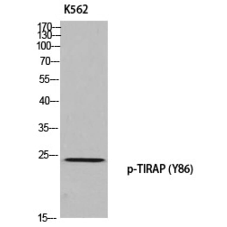 Western blot - TIRAP (Phospho-Tyr86) Polyclonal Antibody from Signalway Antibody (12384) - Antibodies.com