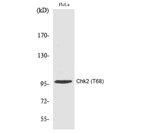 Western blot - Chk2 (Phospho-Thr68) Polyclonal Antibody from Signalway Antibody (12191) - Antibodies.com