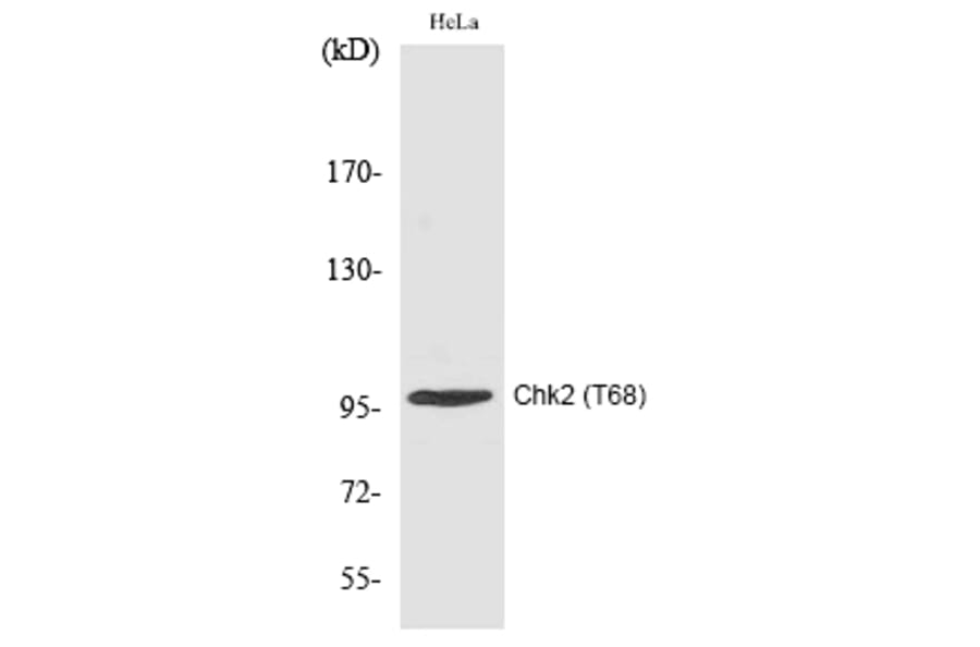 Western blot - Chk2 (Phospho-Thr68) Polyclonal Antibody from Signalway Antibody (12191) - Antibodies.com