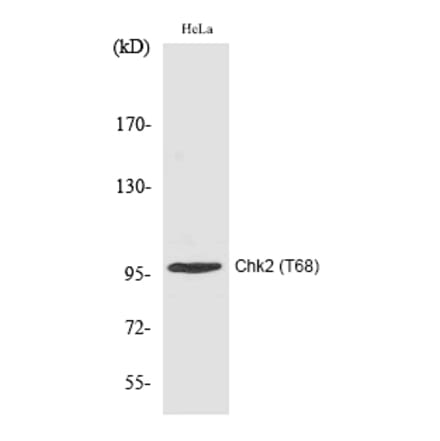 Western blot - Chk2 (Phospho-Thr68) Polyclonal Antibody from Signalway Antibody (12191) - Antibodies.com