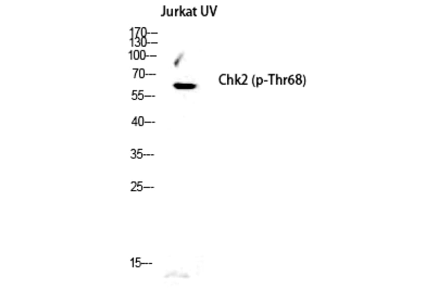 Western blot - Chk2 (Phospho-Thr68) Polyclonal Antibody from Signalway Antibody (12191) - Antibodies.com