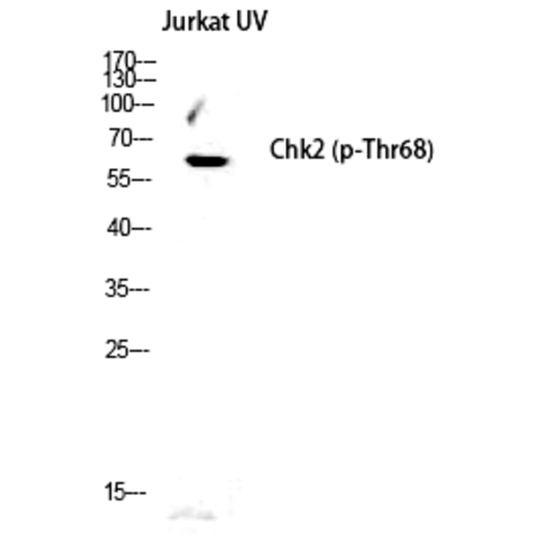 Western blot - Chk2 (Phospho-Thr68) Polyclonal Antibody from Signalway Antibody (12191) - Antibodies.com