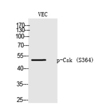 Western blot - Csk (Phospho-Ser364) Polyclonal Antibody from Signalway Antibody (12225) - Antibodies.com