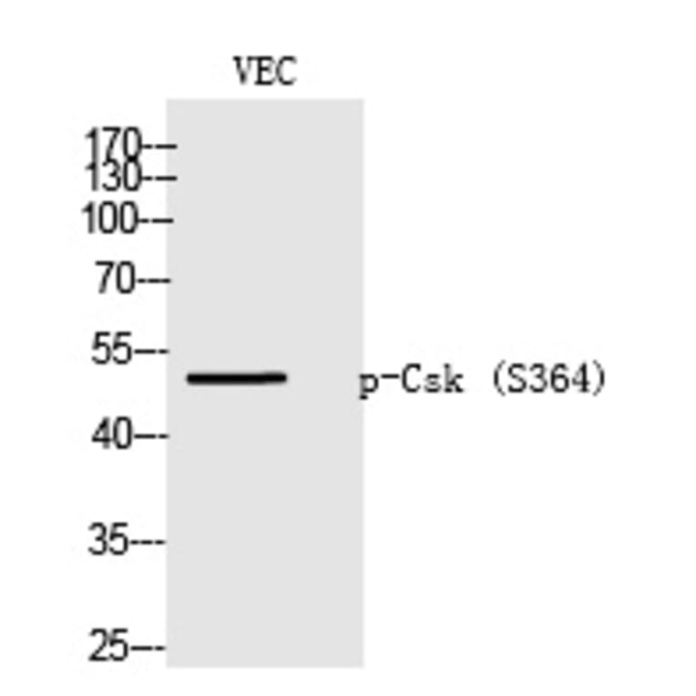 Western blot - Csk (Phospho-Ser364) Polyclonal Antibody from Signalway Antibody (12225) - Antibodies.com