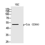 Western blot - Csk (Phospho-Ser364) Polyclonal Antibody from Signalway Antibody (12225) - Antibodies.com