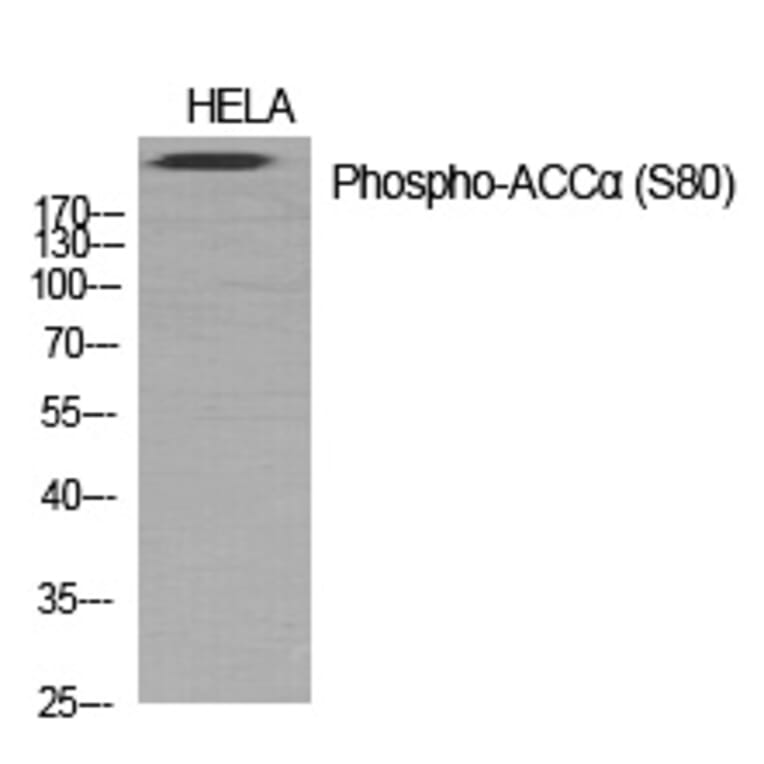 Western blot - ACCα (Phospho-Ser80) Polyclonal Antibody from Signalway Antibody (12284) - Antibodies.com