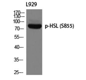 Western blot - HSL (Phospho-Ser855) Polyclonal Antibody from Signalway Antibody (12287) - Antibodies.com
