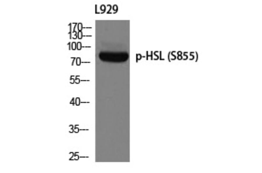 Western blot - HSL (Phospho-Ser855) Polyclonal Antibody from Signalway Antibody (12287) - Antibodies.com
