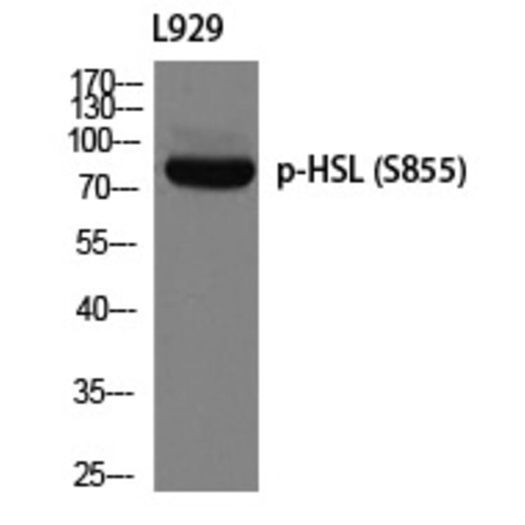 Western blot - HSL (Phospho-Ser855) Polyclonal Antibody from Signalway Antibody (12287) - Antibodies.com