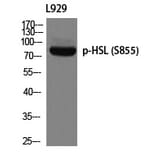Western blot - HSL (Phospho-Ser855) Polyclonal Antibody from Signalway Antibody (12287) - Antibodies.com