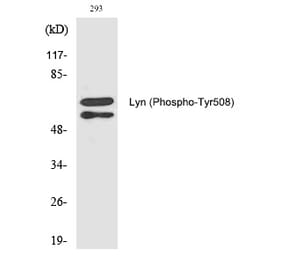 Western blot - Lyn (Phospho-Tyr508) Polyclonal Antibody from Signalway Antibody (12289) - Antibodies.com