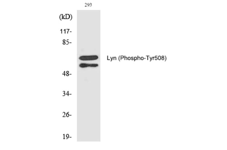 Western blot - Lyn (Phospho-Tyr508) Polyclonal Antibody from Signalway Antibody (12289) - Antibodies.com
