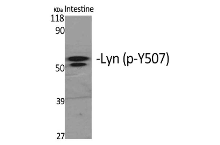 Western blot - Lyn (Phospho-Tyr508) Polyclonal Antibody from Signalway Antibody (12289) - Antibodies.com