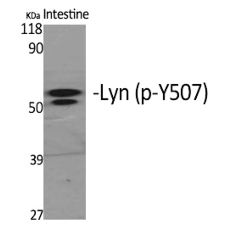 Western blot - Lyn (Phospho-Tyr508) Polyclonal Antibody from Signalway Antibody (12289) - Antibodies.com