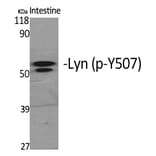 Western blot - Lyn (Phospho-Tyr508) Polyclonal Antibody from Signalway Antibody (12289) - Antibodies.com