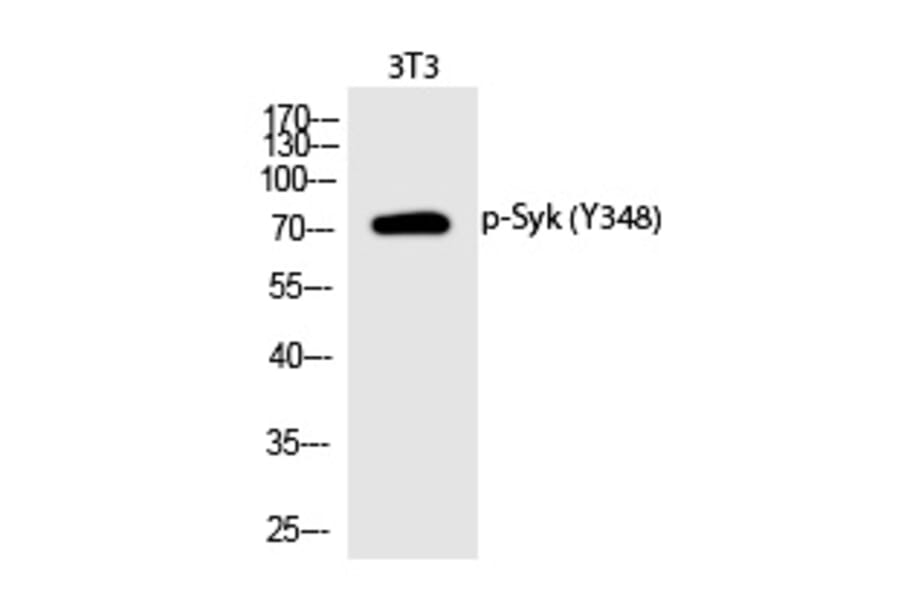 Western blot - Syk (Phospho-Tyr348) Polyclonal Antibody from Signalway Antibody (12293) - Antibodies.com