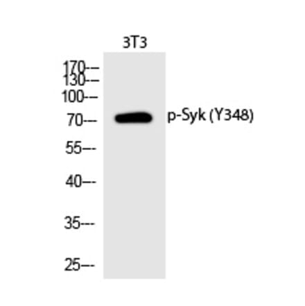 Western blot - Syk (Phospho-Tyr348) Polyclonal Antibody from Signalway Antibody (12293) - Antibodies.com