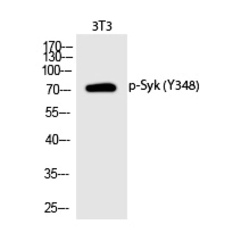 Western blot - Syk (Phospho-Tyr348) Polyclonal Antibody from Signalway Antibody (12293) - Antibodies.com