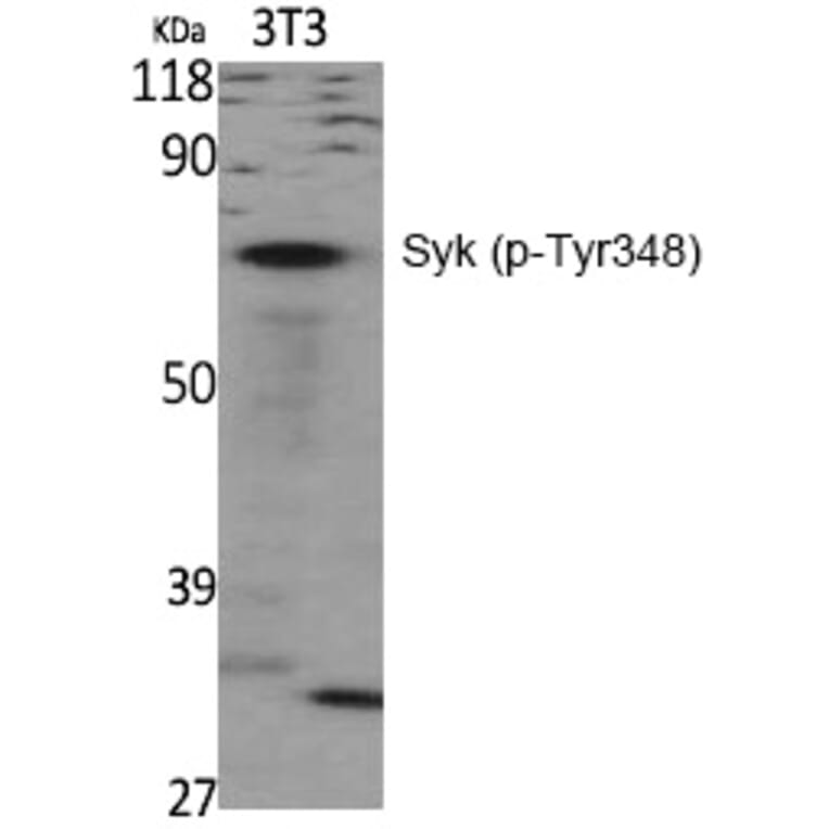 Western blot - Syk (Phospho-Tyr348) Polyclonal Antibody from Signalway Antibody (12293) - Antibodies.com