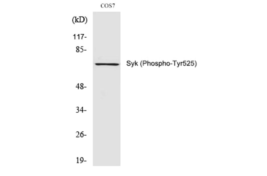 Western blot - Syk (Phospho-Tyr525) Polyclonal Antibody from Signalway Antibody (12294) - Antibodies.com