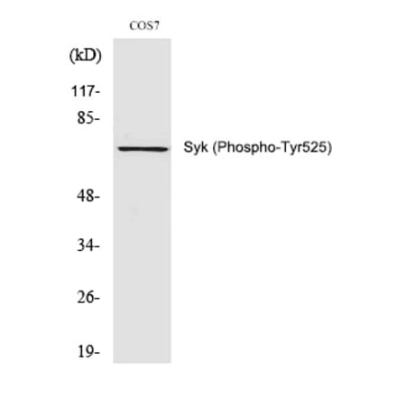 Western blot - Syk (Phospho-Tyr525) Polyclonal Antibody from Signalway Antibody (12294) - Antibodies.com