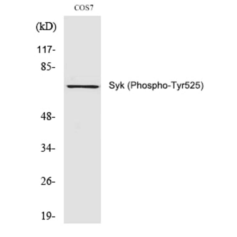 Western blot - Syk (Phospho-Tyr525) Polyclonal Antibody from Signalway Antibody (12294) - Antibodies.com