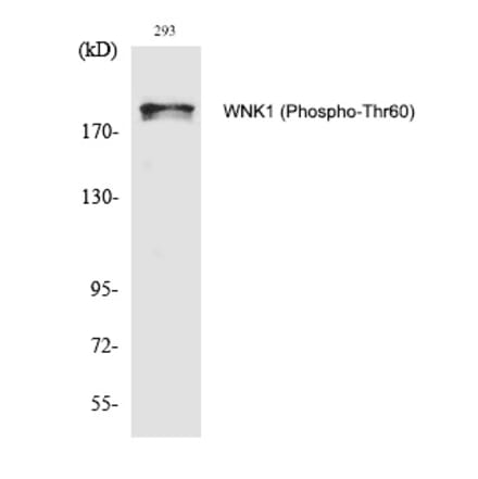Western blot - WNK1 (Phospho-Thr60) Polyclonal Antibody from Signalway Antibody (12295) - Antibodies.com
