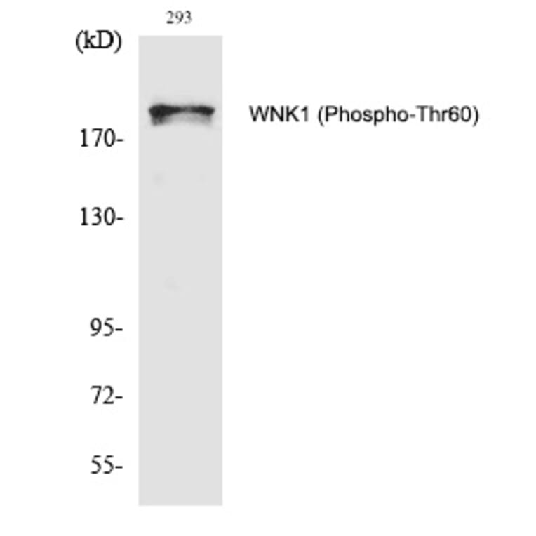 Western blot - WNK1 (Phospho-Thr60) Polyclonal Antibody from Signalway Antibody (12295) - Antibodies.com