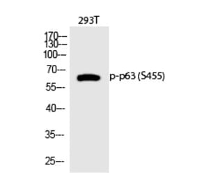 Western blot - p63 (Phospho-Ser455) Polyclonal Antibody from Signalway Antibody (12315) - Antibodies.com