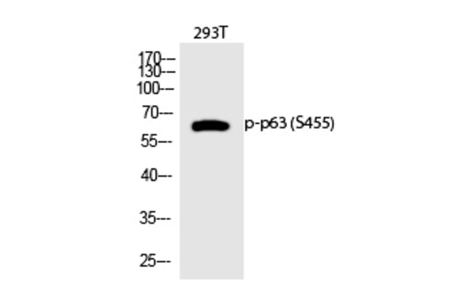 Western blot - p63 (Phospho-Ser455) Polyclonal Antibody from Signalway Antibody (12315) - Antibodies.com