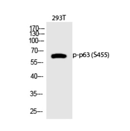 Western blot - p63 (Phospho-Ser455) Polyclonal Antibody from Signalway Antibody (12315) - Antibodies.com
