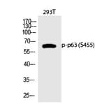 Western blot - p63 (Phospho-Ser455) Polyclonal Antibody from Signalway Antibody (12315) - Antibodies.com