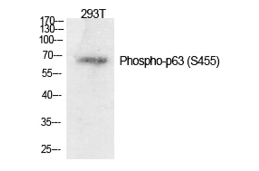 Western blot - p63 (Phospho-Ser455) Polyclonal Antibody from Signalway Antibody (12315) - Antibodies.com