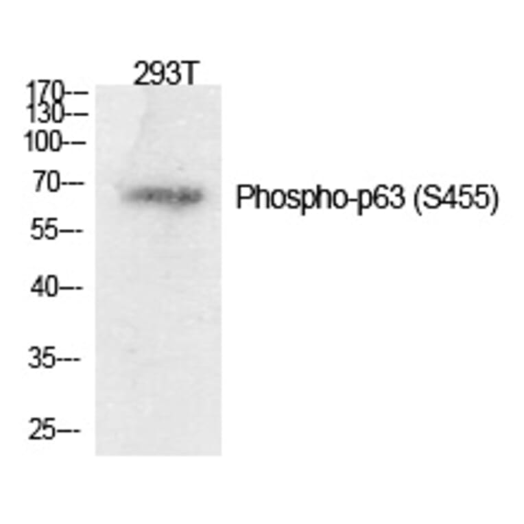 Western blot - p63 (Phospho-Ser455) Polyclonal Antibody from Signalway Antibody (12315) - Antibodies.com
