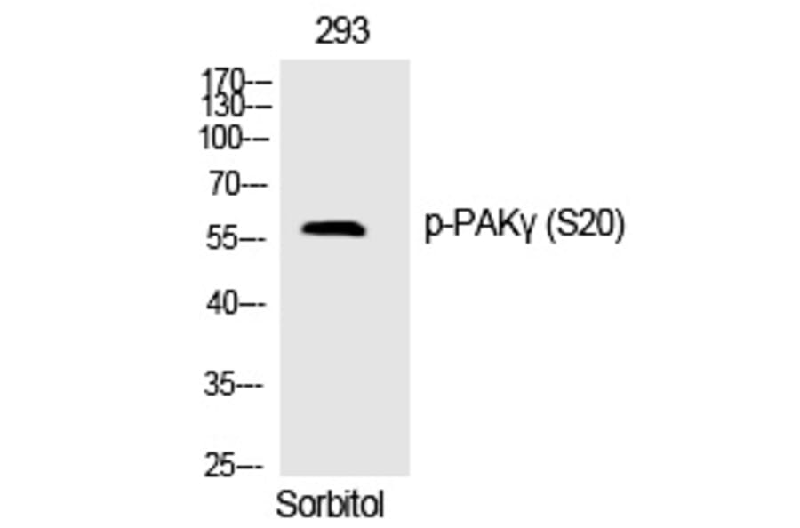 Western blot - PAKγ (Phospho-Ser20) Polyclonal Antibody from Signalway Antibody (12316) - Antibodies.com