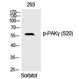 Western blot - PAKγ (Phospho-Ser20) Polyclonal Antibody from Signalway Antibody (12316) - Antibodies.com