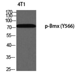 Western blot - Bmx (Phospho-Tyr566) Polyclonal Antibody from Signalway Antibody (12321) - Antibodies.com