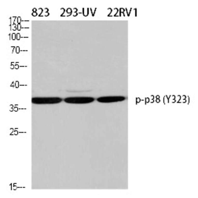 Western blot - p38 (Phospho-Tyr323) Polyclonal Antibody from Signalway Antibody (12322) - Antibodies.com