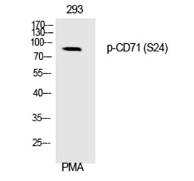 Western blot - CD71 (Phospho-Ser24) Polyclonal Antibody from Signalway Antibody (12325) - Antibodies.com